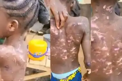 A woman suspected of mistreating and burning her maid is arrested by Abuja CP
