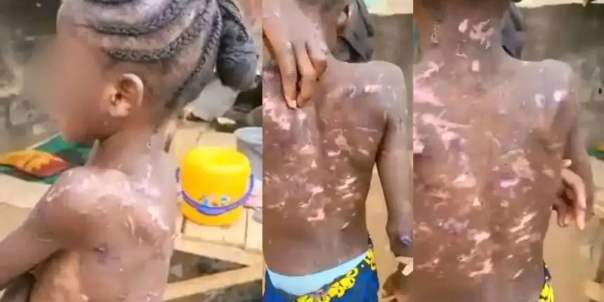 A woman suspected of mistreating and burning her maid is arrested by Abuja CP